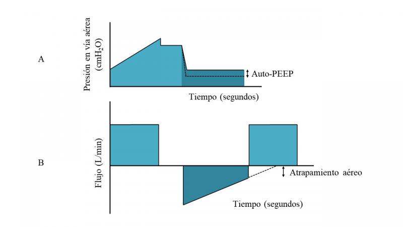 Figura 2. Representación esquemática de una curva presión-tiempo (A) y una curva flujo-tiempo (B) durante la ventilación mecánica controlada por volumen en una situación de atrapamiento de gas en la vía aérea. En la curva de presión-tiempo se observa que el nivel de presión positiva al final de la espiración (PEEP) aplicado es más alto que el programado (auto-PEEP o PEEP intrínseca), y en la curva de flujo-tiempo se observa que la curva de flujo espiratorio no llega a cero antes del inicio del siguiente ciclo respiratorio.