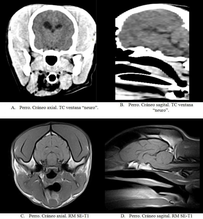 Figura 20. Cráneo TC vs. RMN..