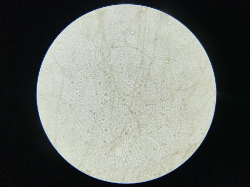 Figura 21. Líquido de un aspirado celómico de un Canthigaster valentini con distensión abdominal, en el que se evidencia presencia de gran cantidad de hifas fúngicas 400x