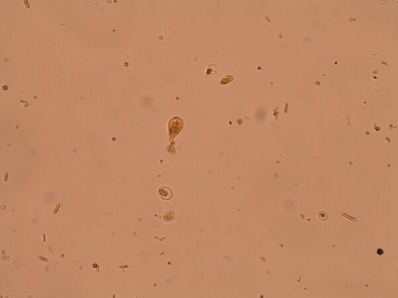 Figura 21. Trofozoito de Giardia duodenalis (MIF) (40x).