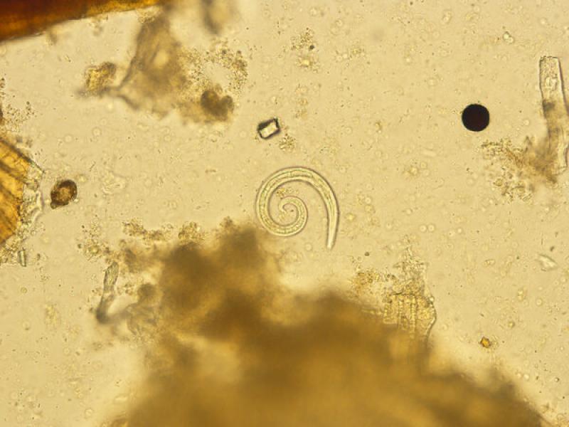 Figura 22. Larva 1 de Angiostrongylus vasorum.