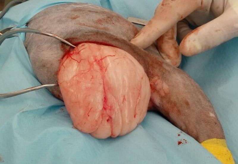 Figura 2a: Cirugía marginal en un lipoma intermuscular en la extremidad posterior. Se ha realizado la escisión inmediatamente alrededor del tumor, sin incluir tejido sano en la resección.