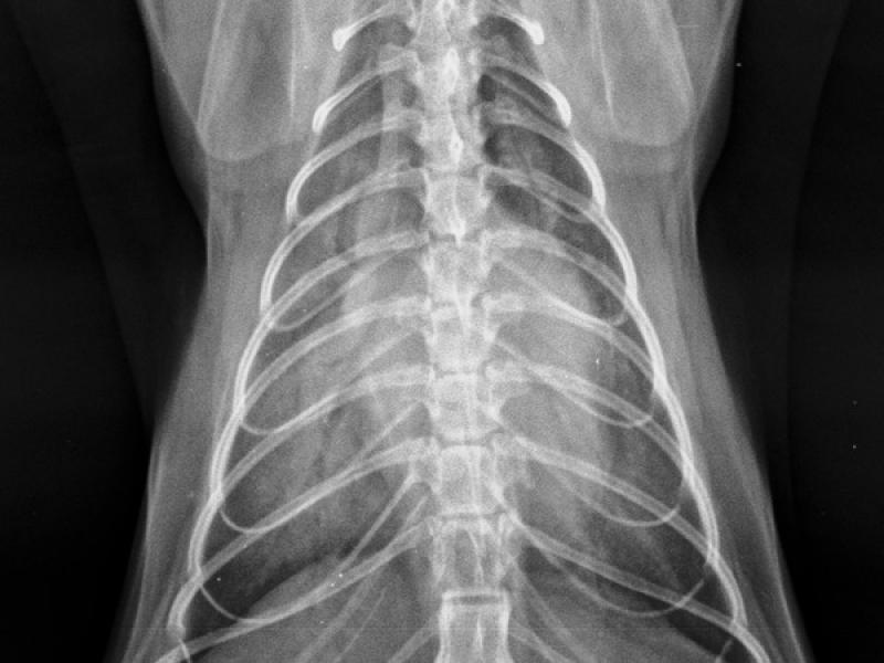 Figura 2A: Radiografías torácicas en proyección dorso-ventral (A) y latero-lateral (B) de una gata con cardiomegalia e infiltrados pulmonares compatibles con edema pulmonar severo.