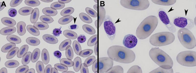 Figura 2A y B. Linfocitos en diferentes especies (Tinción Wright, magnificación a partir de preparaciones visualizadas por microscopio a 100x). (A) Linfocitos de pequeño tamaño en una gallina doméstica (Gallus gallus domesticus) (asterisco) y trombocito (punta de flecha). Se pueden observar las protuberancias citoplasmáticas, características de los linfocitos activados. (B) Linfocitos en una tortuga terrestre de patas rojas (Chelonoidis carbonaria) (astersicos) y trombocitos (puntas de flechas). Se puede observar el color azulado de su citoplasma (a diferencia del color transparente de los trombocitos). .