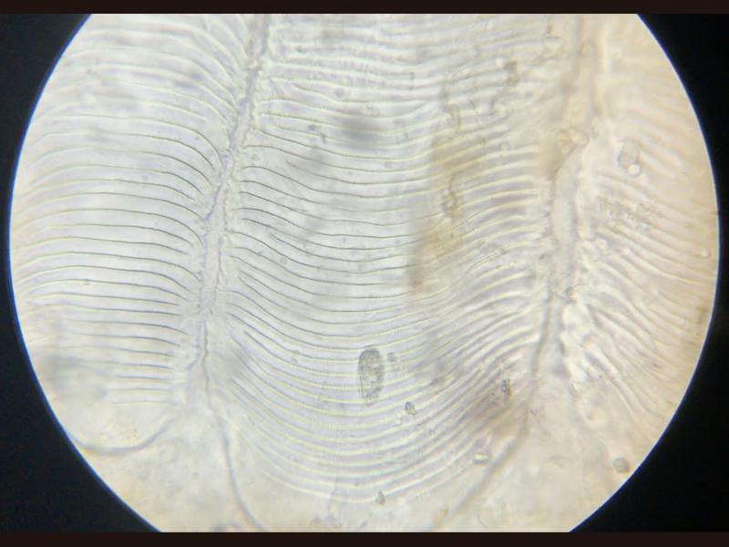 Figura 2b. Ciliado Uronema spp por debajo de una escama de una Chromis viridis 100x