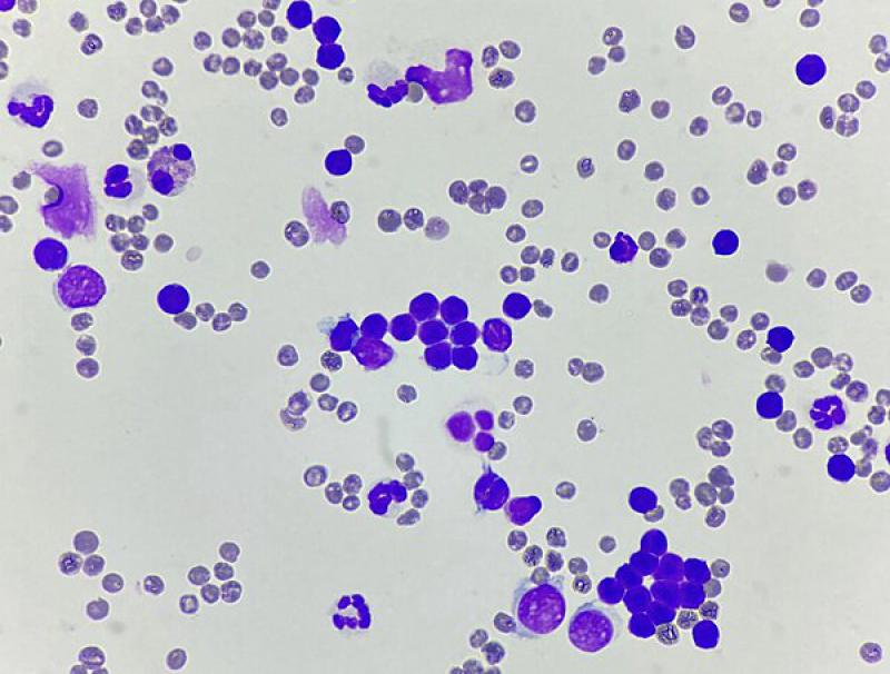 Figura 3. Citología de quilotórax en un gato en la que predominan los linfocitos pequeños. Imagen cedida por T-cito.