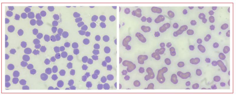 Figura 3. En la imagen de la izquierda se observan merozoítos de Babesia caballi y en la imagen de la derecha de Theileria equi parasitando eritrocitos.