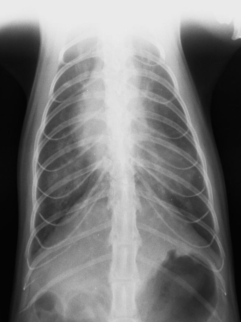 Figura 3. Hallazgos radiográficos en posicionamiento dorsoventral. (A) Patrón bronquial evidente con aerofagia y detalle de tórax en forma de tonel debido a estado de hiperinsuflación pulmonar.