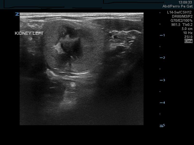 Figura 3. Imágenes ecográficas de riñon izquierdo durante el proceso de diagnóstico.
