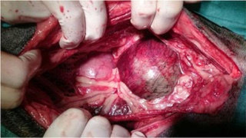 Figura 3. Paciente con necrosis de estómago.