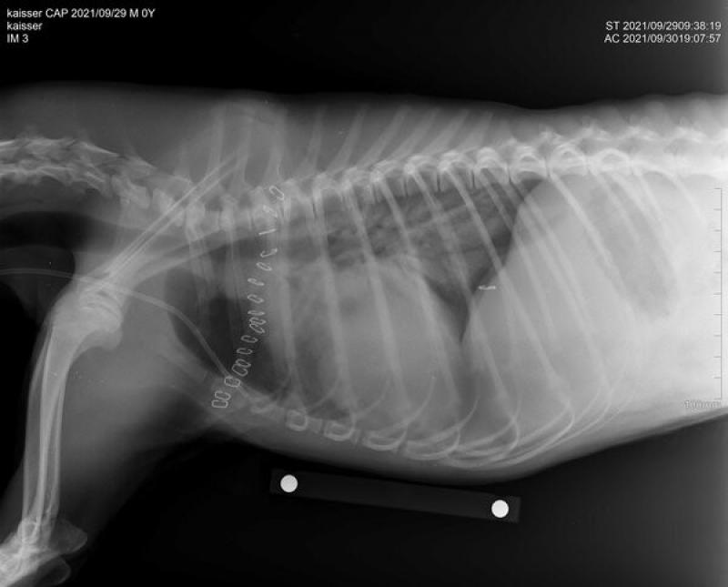 Figura 3: Radiografía del paciente del caso 1.