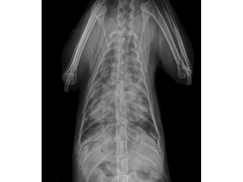 Figura 3. Radiografía torácica usando una proyección dorso-ventral en el mismo paciente. Se muestra severo patrón bronco-intersticial difuso y bilateral.