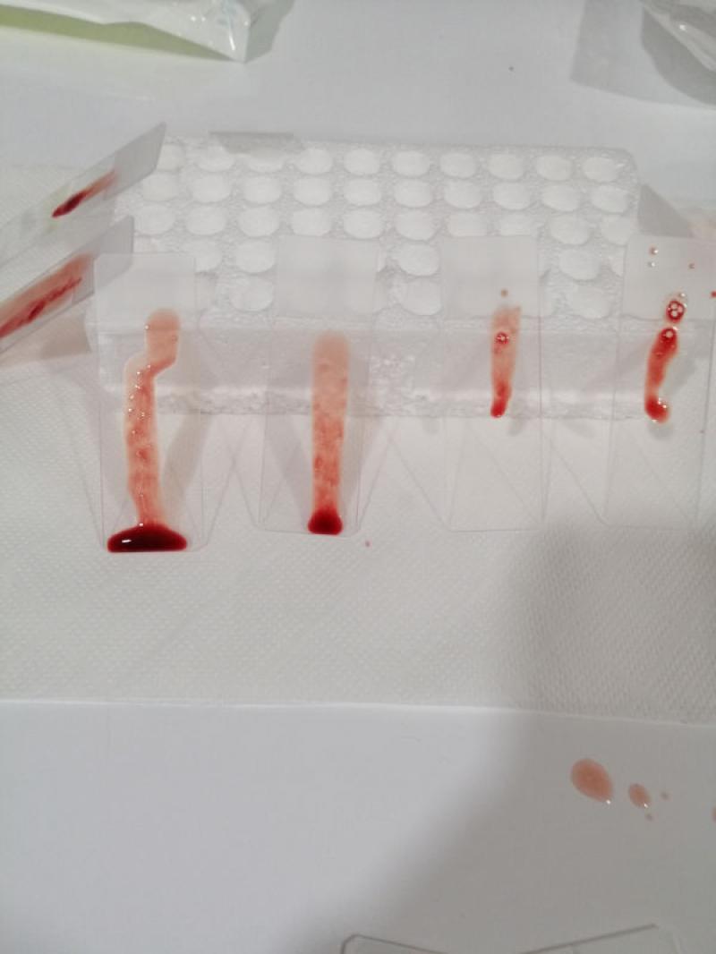 Figura 3. Se pone la muestra sobre los portaobjetos inclinados para que el exceso de sangre se vaya hacia abajo del portaobjeto, y en la parte superior queden las espículas. También, en tubos con EDTA.