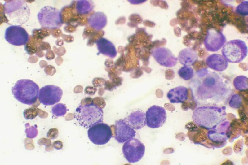 Figura 33. Mastocitoma, presencia de células redondas con presencia de numerosos gránulos citoplasmáticos metacromáticos.