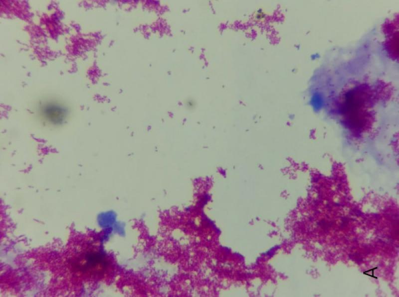 Figura 3A. Tinción de Z-N de un cultivo positivo de micobacterias.
