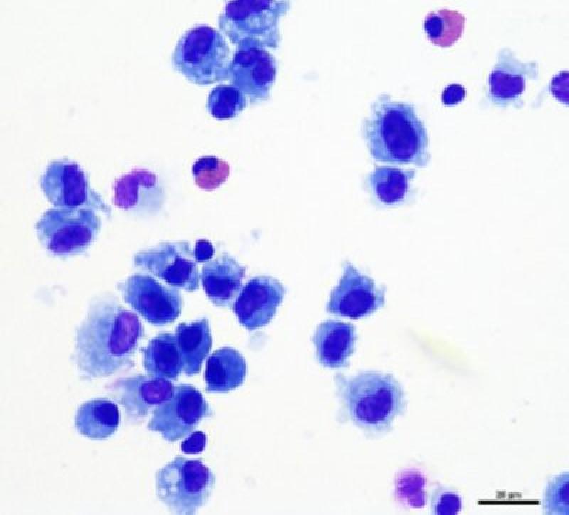 Figura 4. Imagen microscópica (x50). En la imagen de la izquierda se observan eosinófilos de un lavado traqueal de caballo.