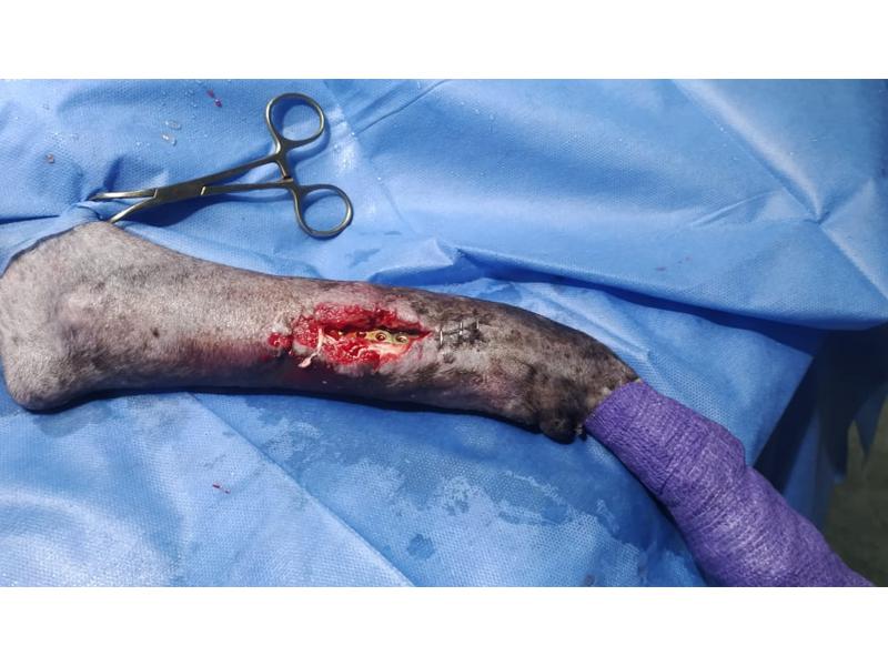 FIGURA 4. Infeccion del sitio quirurgico SSI, Implante y hueso expuesto.