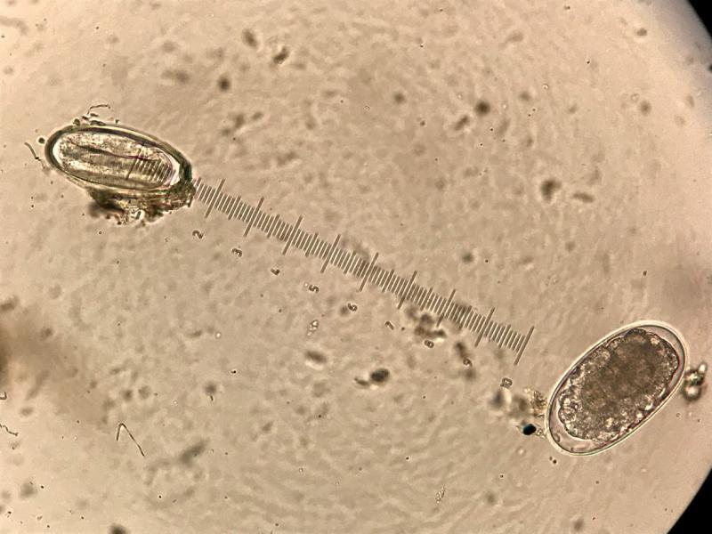 Figura 4. Infección mixta arriba a la izquierda huevo larvado de Oxyuris equi y abajo a la derecha huevo de estrongilado o estrongílido.
