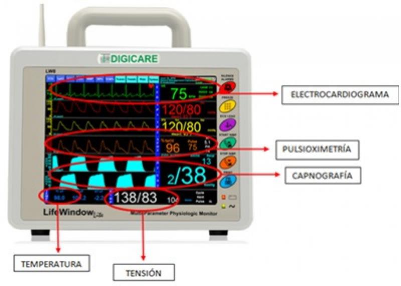 Figura 4. Monitor de quirófano. En la parte de arriba se observa la gráfica del electrocardiograma, con la FC a su derecha; seguido, la pulsioximetría con los valores de la SpO2 y el pulso; a continuación, la capnografía con los valores de EtCO2. Abajo a la izquierda, los valores de la temperatura corporal y en el centro, la tensión arterial.