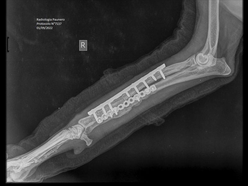 FIGURA 4. Radiografías posoperatorias, donde se evidencia la osteomielitis en curso (reacción periodística, inflamación de tejidos blandos zonas de lísis).