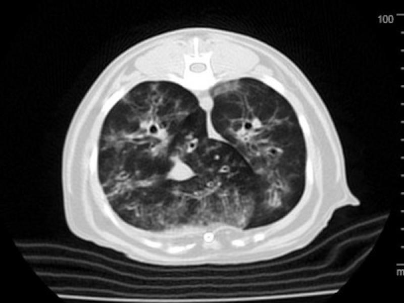 Figura 4. Tommografías computerizadas de gatos con bronquitis crónica. (A) Engrosamiento generalizado de las paredes bronquiales y aumento de densidad peribronquial, sugestivo de bronquitis inflamatoria/infecciosa crónica.