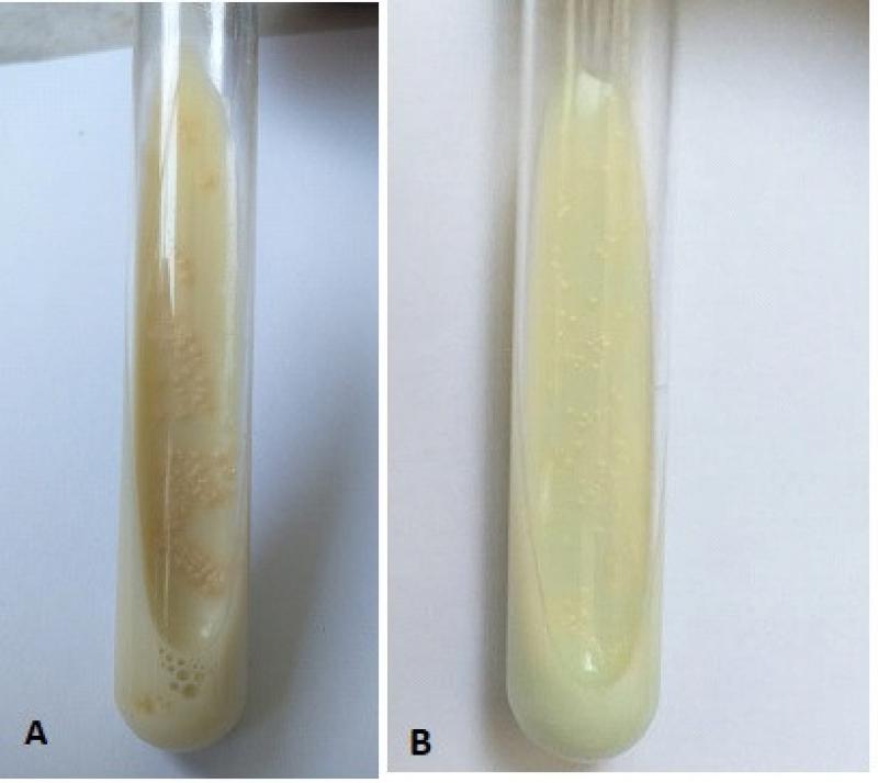 Figura 4.Cultivos en medio de LJ con crecimiento de MAC, desarrollo de micobacteria atípica (A) y desarrollo de Mycobacterium avium (B).