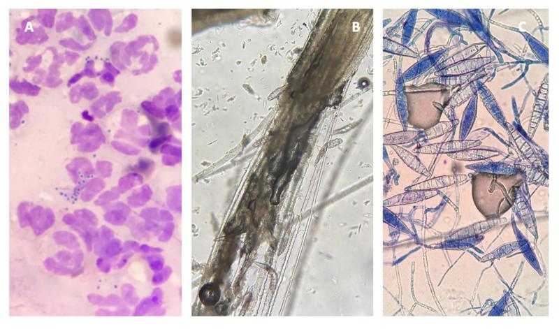 Figura 5: A. Citología de pioderma en la que se observan neutrófilos con cocos intracelulares B. Ácaros del género Demodex observados durante el estudio microscópico del pelo C. Macroconidias de Microsporum canis en cultivo DTM
