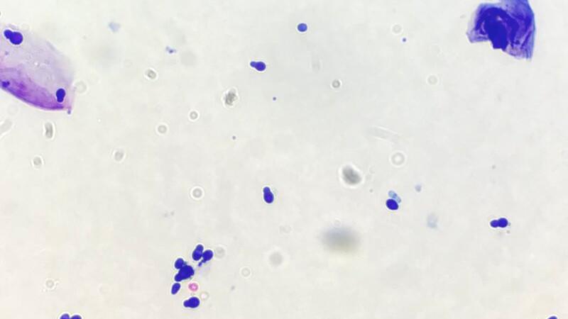 Figura 5. Citología por hisopo: infección por Malassezia.
