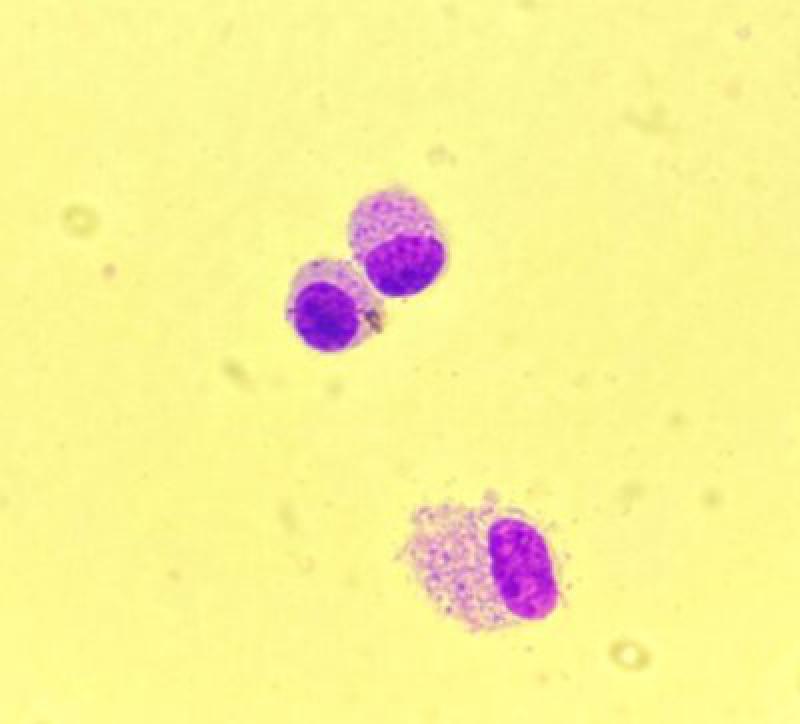 Figura 5. Imagen microscópica (x100). En la imagen se observan mastocitos de un lavado traqueal de caballo.