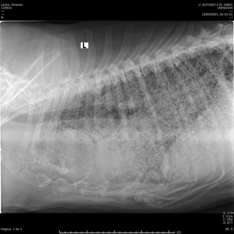 FIGURA 5. Radiografía de tórax lateral con patrón miliar por metástasis de HSA de bazo. Cortesía de Ana González Hernández Servicio de diagnóstico por imagen del HCV UAX.