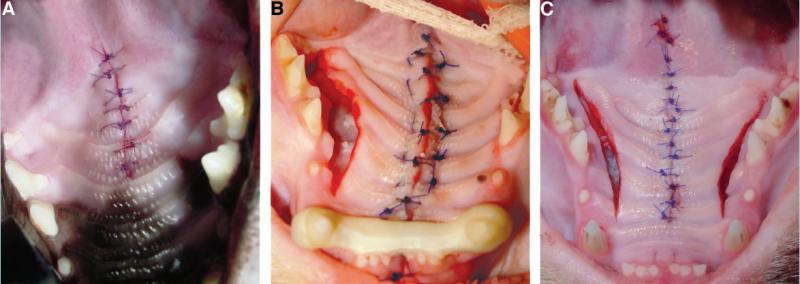 Figura 5: Resolución quirúrgica de fractura palatina dependiendo del criterio del cirujano y de la gravedad de la fractura.