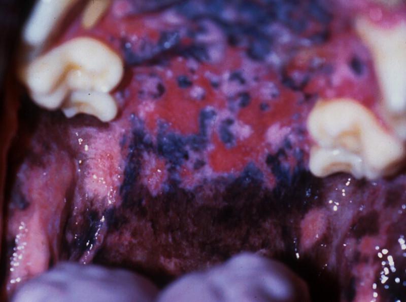Figura 5. Úlceras en mucosa oral de un perro afectado de pénfigo vulgar. Imagen cortesía del Dr. José Luis González Arribas.