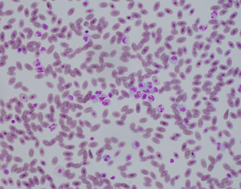 Figura 5A. (A) Monocitosis en el frotis de un dragón de agua chino (Physignathus cocincinus). También podemos observar los cambios tóxicos de los heterófilos. (B-C) Monocitosis en el frotis de un uromastyx (Uromastyx negriventris) (Tinción Wright, magnificación a partir de preparaciones visualizadas por microscopio a 40-100X).