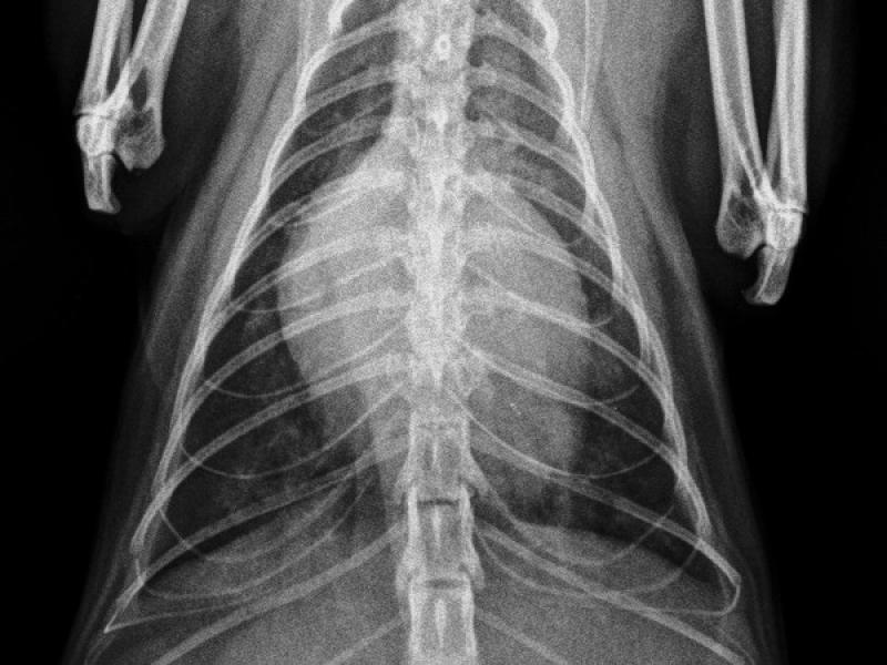 Figura 5A: Radiografías torácicas en proyección dorso-ventral (A) y latero-lateral (B) de una gata con cardiomegalia severa y leves infiltrados pulmonares.