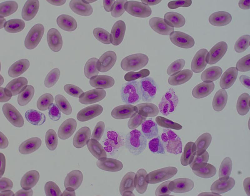 Figura 5B. (A) Monocitosis en el frotis de un dragón de agua chino (Physignathus cocincinus). También podemos observar los cambios tóxicos de los heterófilos. (B-C) Monocitosis en el frotis de un uromastyx (Uromastyx negriventris) (Tinción Wright, magnificación a partir de preparaciones visualizadas por microscopio a 40-100X).