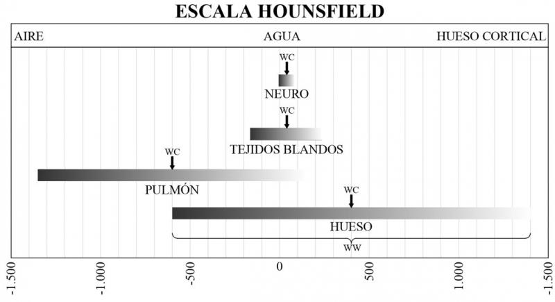 Figura 6. Representación gráfica de las ventanas más comunes sobre la escala Hounsfield.
