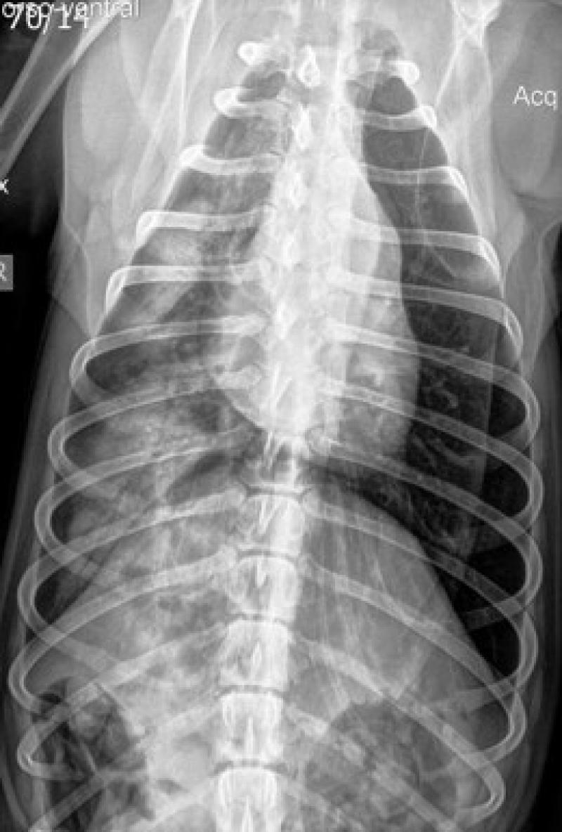 Figura 7. Sobrexposición más marcada en los aspectos laterales del tórax y en general del pulmón izquierdo en el que apenas se visualizan vasos pulmonares.