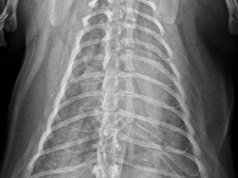 Figura 8B: Radiografías torácicas en proyección dorso-ventral (A) y latero-lateral (B) de un gato con edema pulmonar severo y cardiomegalia.