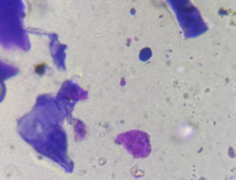 Figura 9. Fotografía de la muestra tomada mediante cinta de acetato dónde se observa una levadura compatible con Malassezia pachidermatis.