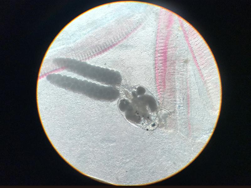 Figura 9b. Presencia de hembra de Ergasilus sp. anclada sobre filamento branquial 100x