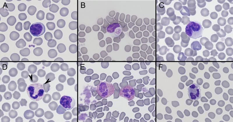 Figura A1. Células sanguíneas en cobaya (Cavia porcellus). (A) Linfocito. (B) Célula de Kurloff. (C) Monocito. (D) Heterófilo (puntas de flecha). (E) Eosinófilos. (F) Basófilo.