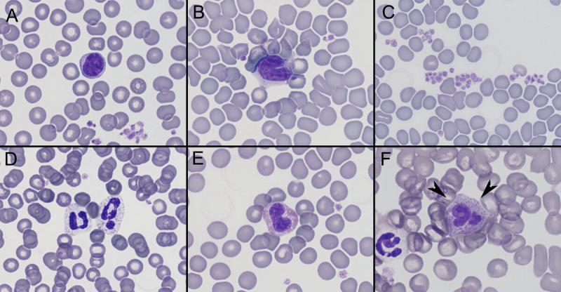 Figura A2. Células sanguíneas en chinchilla (Chinchilla lanigera). (A) Linfocito. (B) Monocito. (C) Agregado de plaquetas. (D) Heterófilo. (E) Eosinófilo. (F) Basófilo (puntas de flecha).