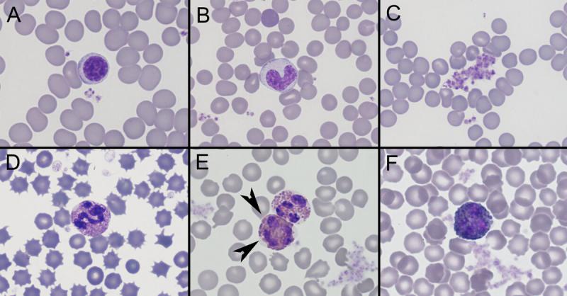 Figura A3. Células sanguíneas en conejo (Cryctolagus cuniculus). (A) Linfocito. (B) Monocito. (C) Agregado de plaquetas. (D) Heterófilo. (E) Eosinófilo (puntas de flecha) y Heterófilo. (F) Basófilo.