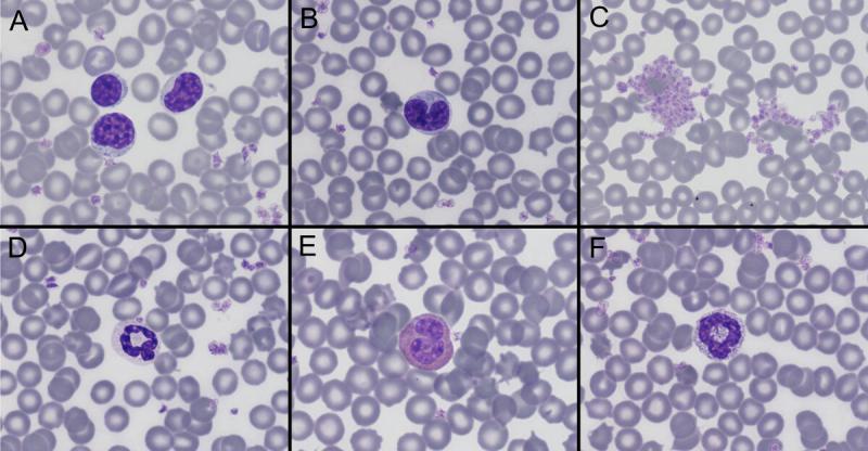 Figura A4. Células sanguíneas en rata (Rattus norvegicus). (A) Linfocito. (B) Monocito. (C) Agregado de plaquetas. (D) Neutrófilo. (E) Eosinófilo. (F) Basófilo.