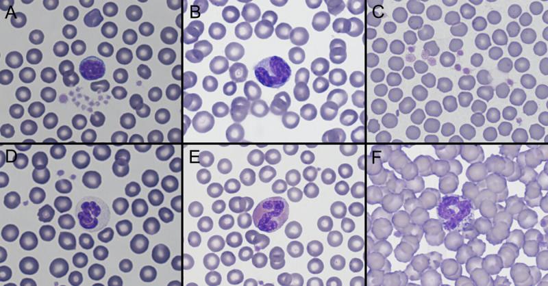 Figura A5. Células sanguíneas en hurón (Mustela putorius furo). (A) Linfocito. (B) Monocito. (C) Plaquetas. (D) Neutrófilo. (E) Eosinófilo. (F) Basófilo.