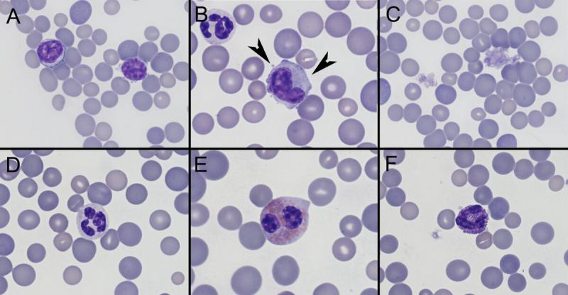 Figura A6. Células sanguíneas en erizo (Atelerix albiventris). (A) Linfocito. (B) Monocito (puntas de flexa). (C) Agregados plaquetas. (D) Neutrófilo. (E) Eosinófilo. (F) Basófilo.